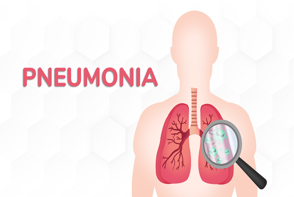 Pneumonia